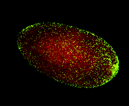图4,感染了沃尔巴克体的果蝇细胞的共聚焦显微图像,图中红色的是细胞