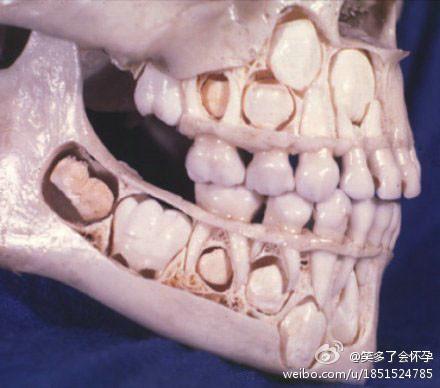换牙之前那些被换出来的牙齿在哪里呢?
