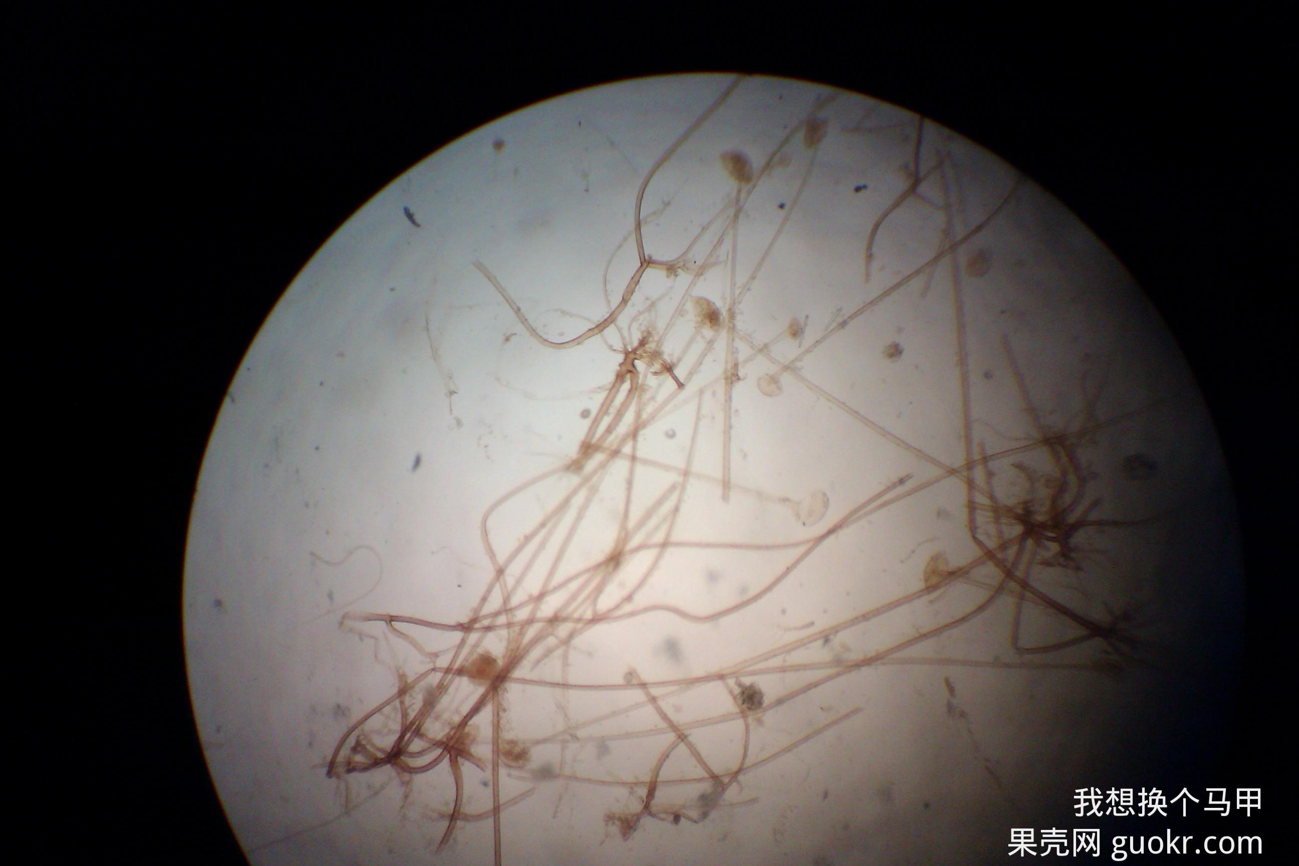 毛霉属无假根和匍匐丝,但是显微镜下看到的毛霉上的根